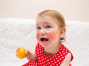 Príznaky alergie na citrusy