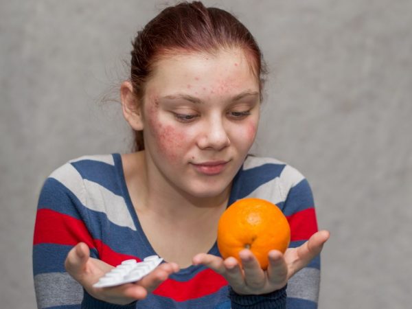 Vylúčte z potravy citrusové plody